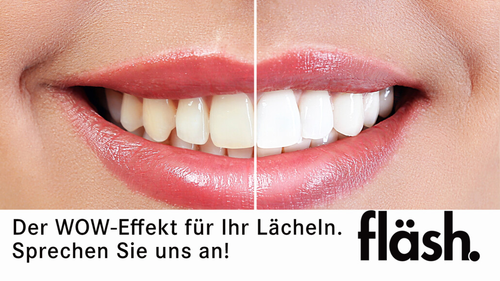 Vorher vs. Nachher - fläsh Zahnaufhellung in Regensburg