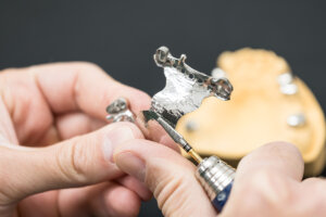 Teleskop-Prothese aus unserem eigenen Labor Teleskop-Prothese, gefertigt im eigenen Dentallabor